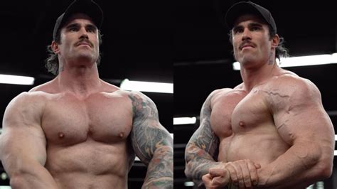 Calum Von Moger: ‘I’m Doing Better, Got All The Help I Needed。